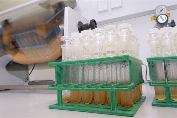 Muestras de orina en un laboratorio de análisis. En un futuro, las baterías podrían funcionar con desechos orgánicos tras los anuncios realizados por los investigadores de la Universidad de Bristol. (Foto: AP)