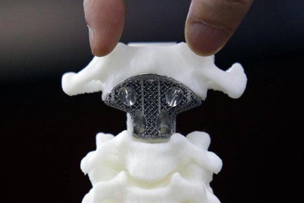 La vértebra fabricada con una impresora 3D. (Foto: Reuters).